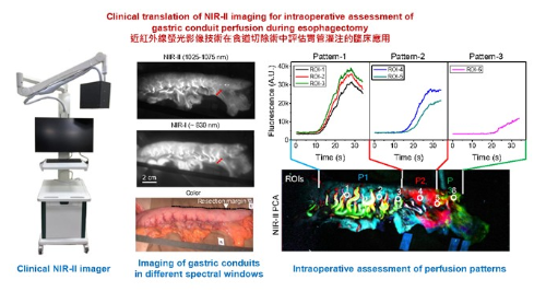 港大新一代红外线萤光成像技术的应用 港大新一代红外线萤光成像技术的应用