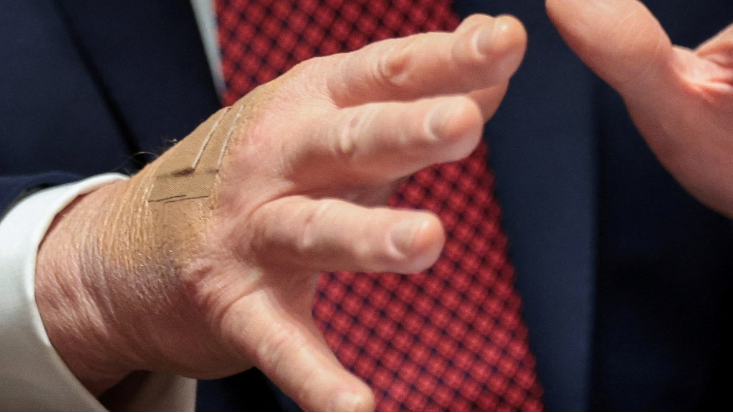 特朗普手背再贴胶布 特朗普手背再贴胶布