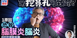 常挖鼻孔可致命？1原因恐致脑膜炎/脑炎，挤暗疮也高危