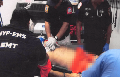 急救人员正在对爱泼斯坦进行心肺复苏