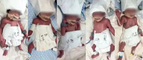 24岁新疆产妇诞5胞胎