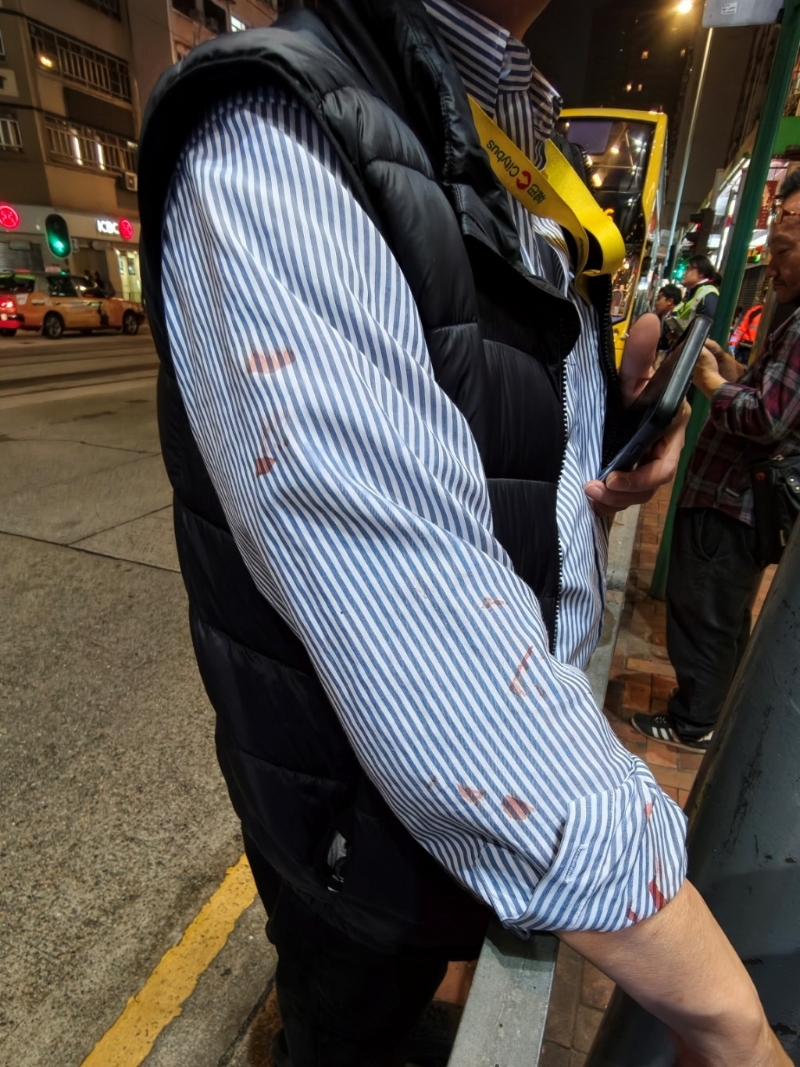 车长制服被疑犯血迹所染。