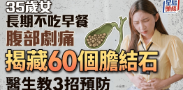 35岁女长期不吃早餐腹部剧痛，求医揭藏60个胆结石，医生教3招预防