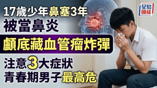 17岁少年鼻塞3年被当鼻炎